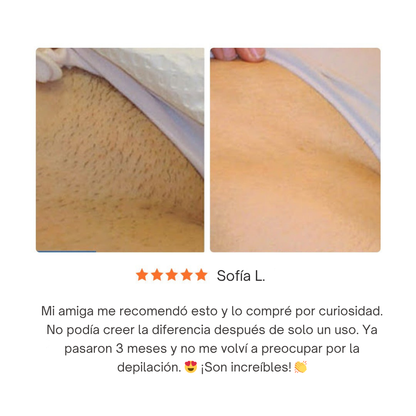 Epify, Depilación Rápida, Indolora y Duradera